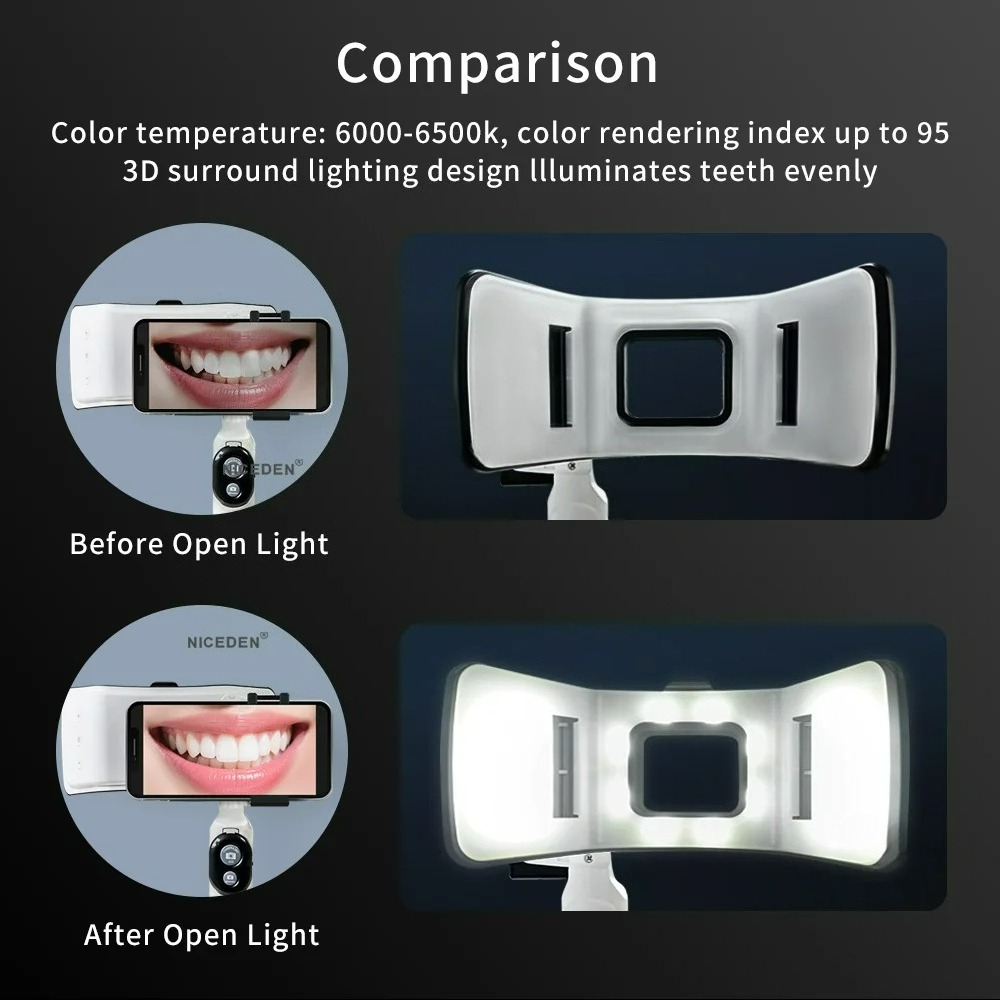 Dental Photography Light Phone - огляд і ціна Photography Lighting Accessories